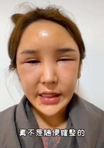 网红桃花宝宝多次整容,额头鼓起疼到睡不着,自曝被医院拒收