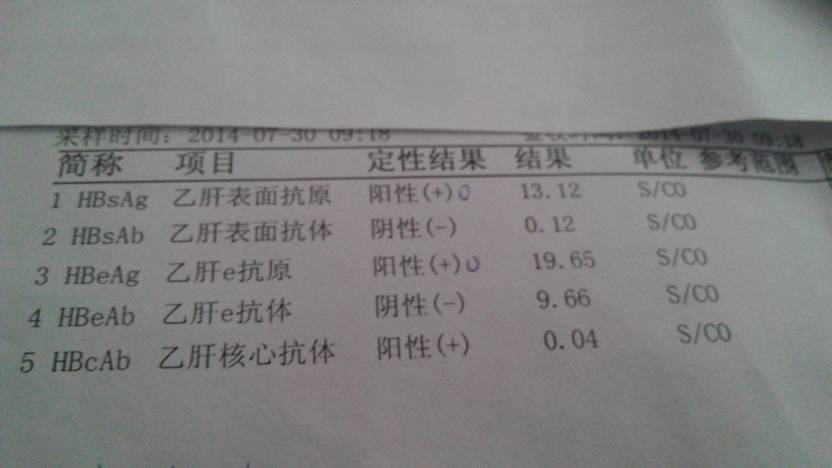 一般来说,e抗体阳性意味着体内乙肝病毒正在减少,传染性降低,e抗体低