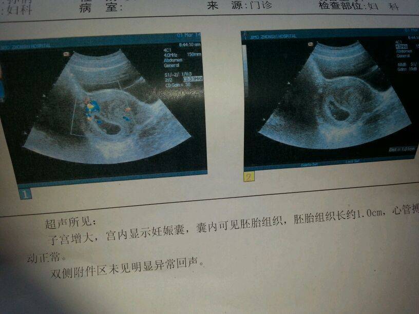 怀孕40周B超检查全攻略,B超产检目的和注意事项,孕妈要知道