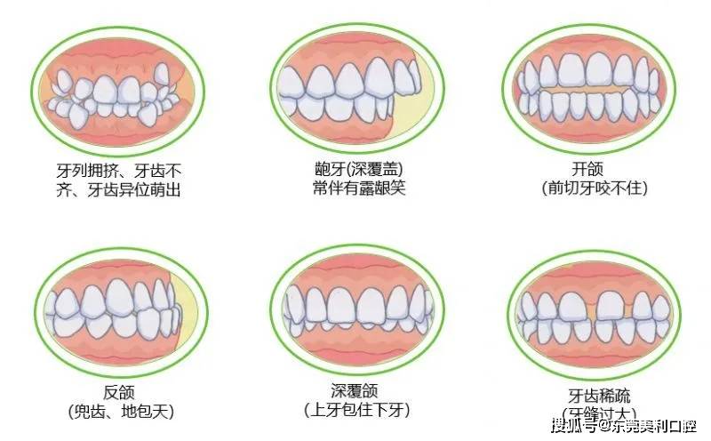 儿童替牙期牙齿常出现的几种问题,家长必须知道!