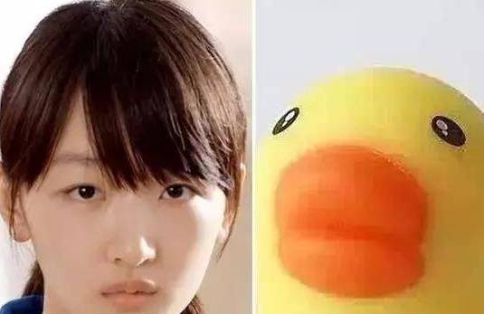 画面感好强!汪苏泷把脸摔成多边形,周冬雨拔完智齿脸超肿