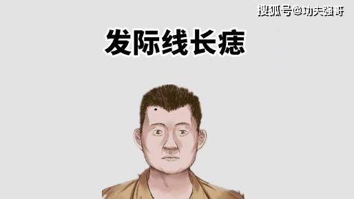 在相学中,如果一个人发际线的地方处长有恶痣,他们的运势往往一般,会