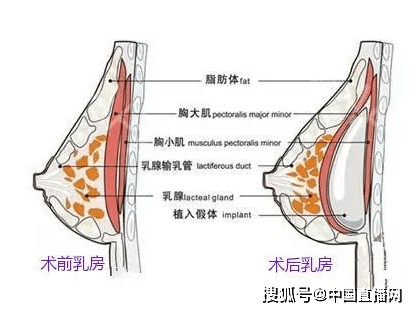 自身胸廓组织厚度