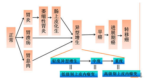 哪些人是高危人群?会患胃癌吗