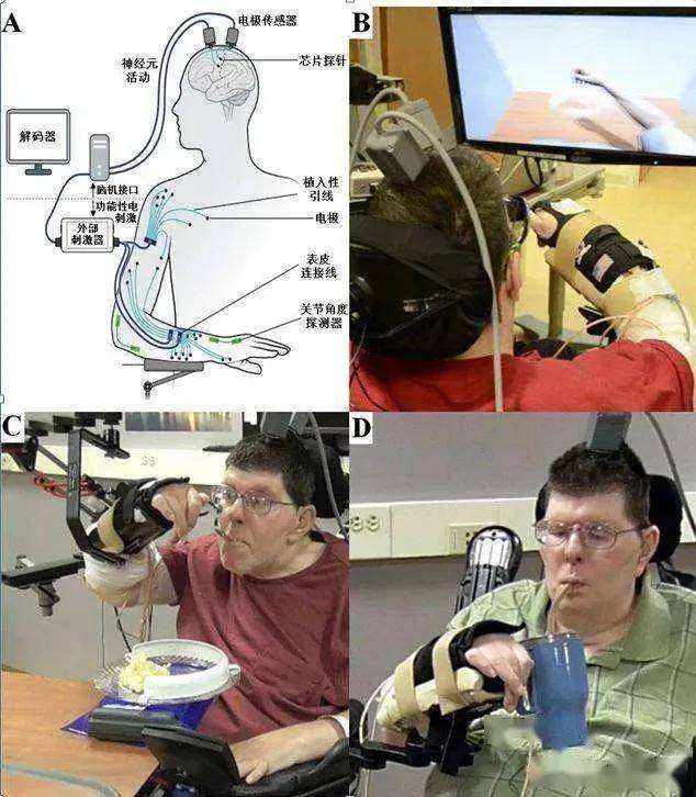 你所不了解的脑机接口技术,正在从科幻走进现实的又一