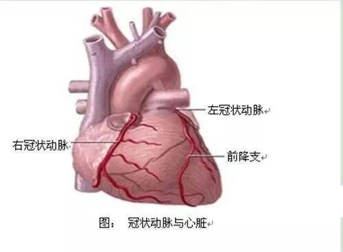 什么是【冠状动脉造影】?