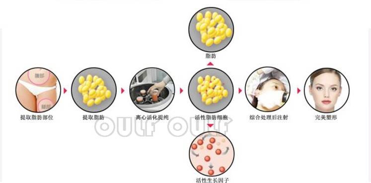 3,活细胞美 容可以促进皮肤中胶原蛋白和弹性纤维的形成,使皮肤更有