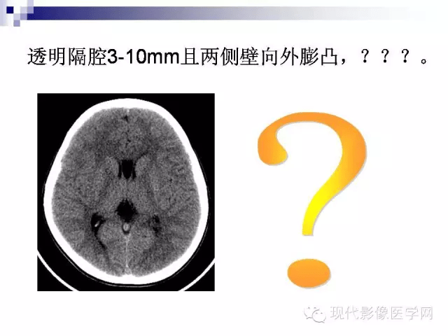 什么时候报透明隔间腔增宽