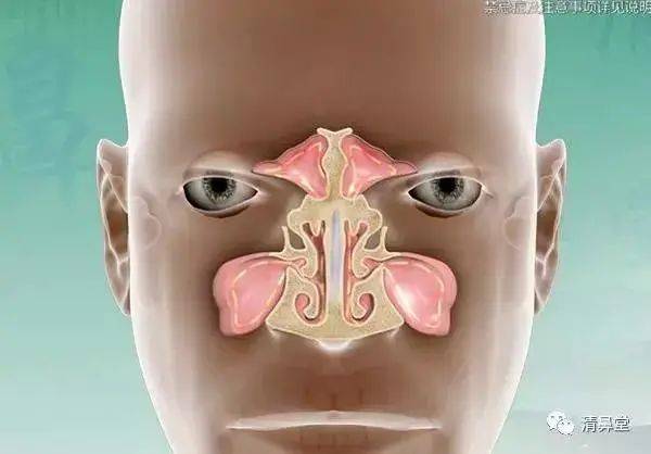 其他鼻炎,鼻息肉,鼻中隔偏曲,中鼻甲肥大,鼻腔异物或鼻腔肿瘤,都有
