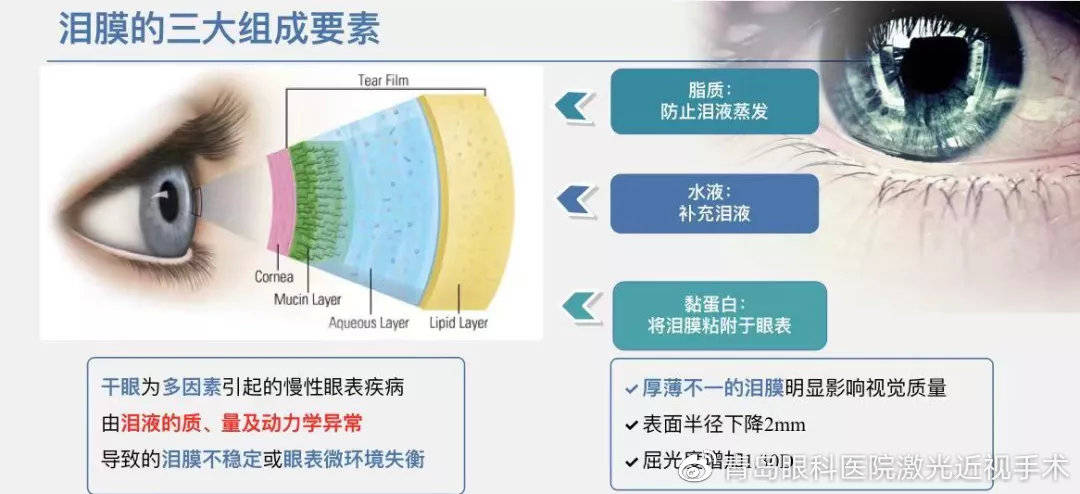 流泪竟然也是干眼惹的祸_治疗_泪膜_泪液