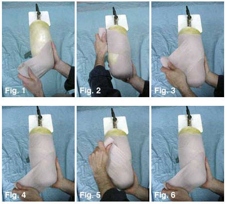 残肢的护理及弹性绷带的使用方法