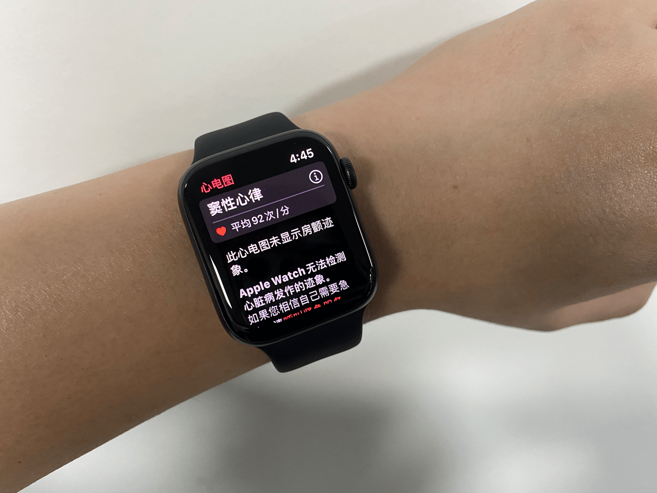 applewatch国行版ecg功能上线它对日常生活真的有用吗