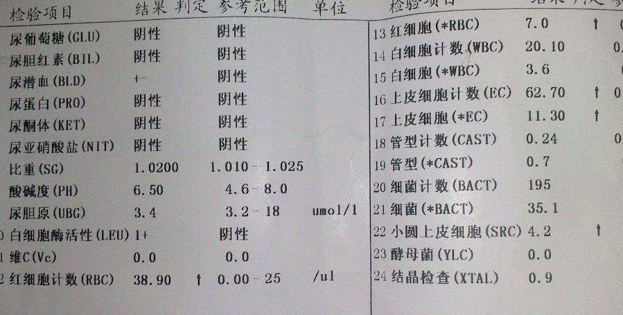 尿常规检查,若这2项带加号,可能情况比较紧急,最好入院治疗_化验单