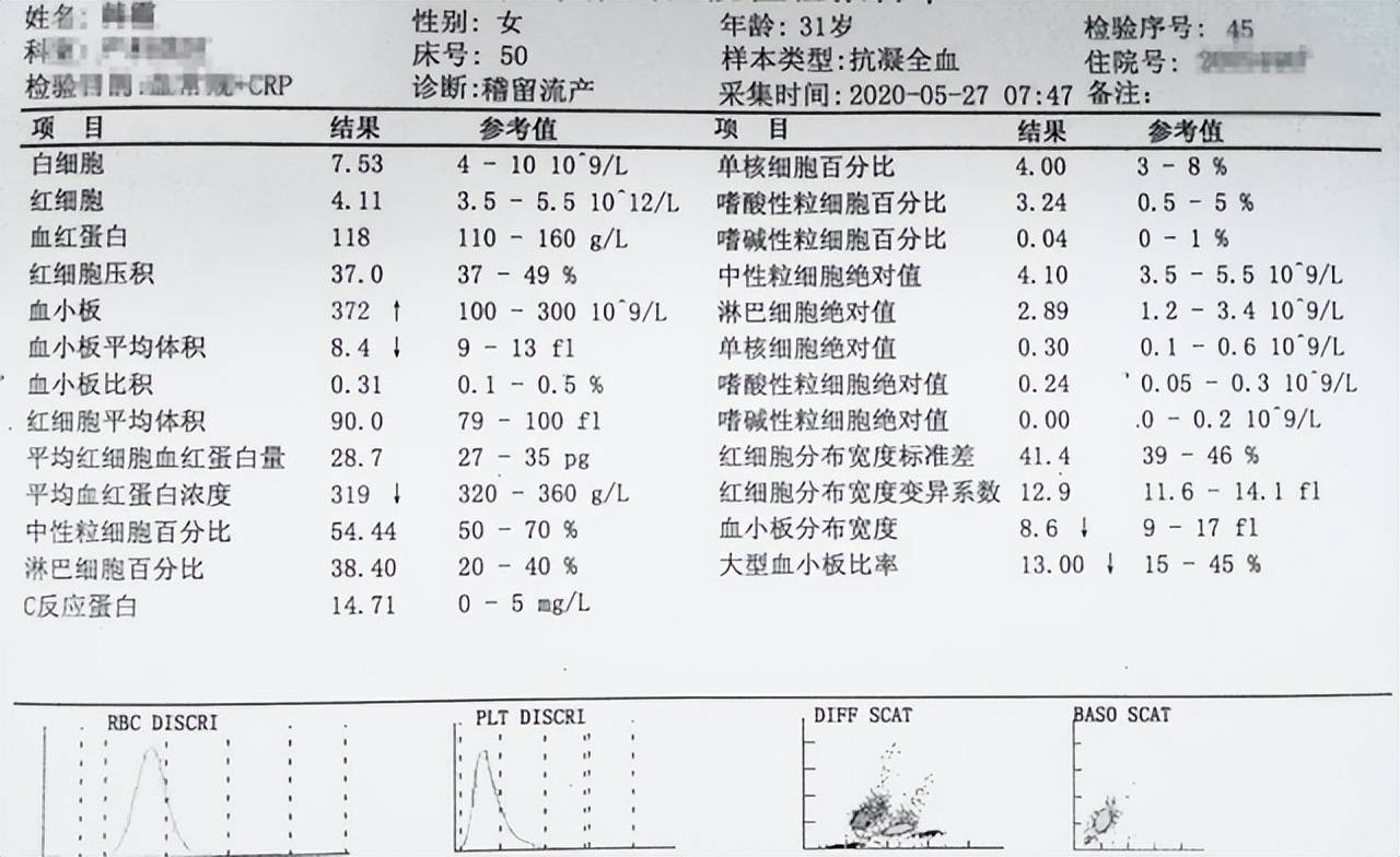 孕妇吃＂不卫生＂食物,怀孕24周,生下仅重670g＂超早产＂宝宝