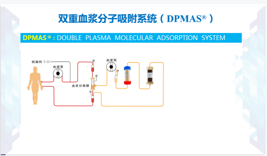 医院成功实施首例"人工肝 人工肾"联合治疗(cpfa)_患者_吸附_血浆