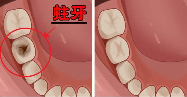 双胞胎姐妹,一个从小吃水果,一个喝果汁,6岁时体检差距大