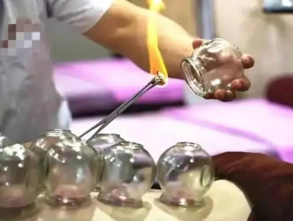 (拔罐减肥)3.生物反馈(腹部塑形,大腿塑形)治疗:4.