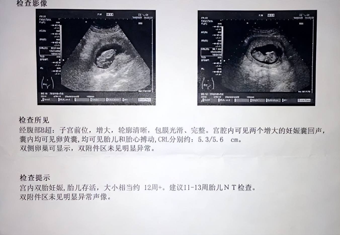 ＂胎儿摄影＂悄悄流行,表面上是给娃留纪念,＂粉蓝礼物＂藏暗语