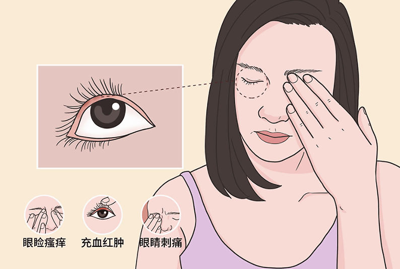 换季小妙招帮你缓解眼睛干涩