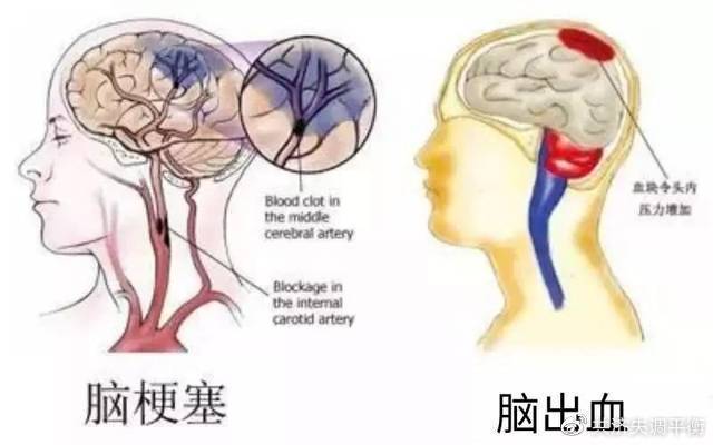 症状_肢体_眩晕