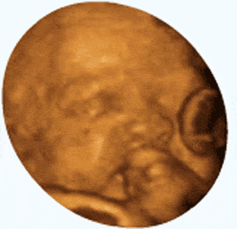 3,一孕妈在12周的b超检查中,发现小胎儿正顽皮地上窜下跳,逗得她不禁