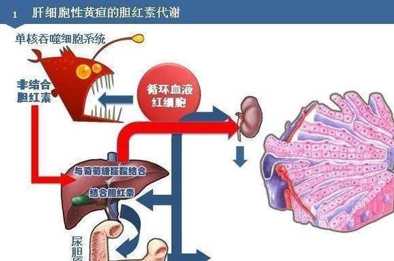 慢乙肝总胆红素偏高 为什么？