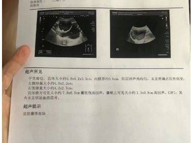 成都助孕中心（中医调理助孕，让不孕女性的好孕如期而至）