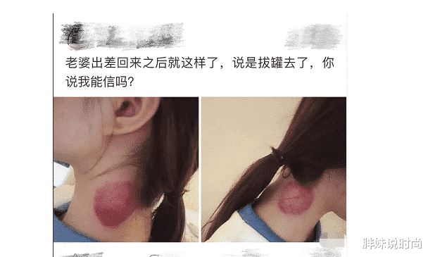 “女友出差回来后脖子有红印，问她说是拔罐了”我该相信她吗？