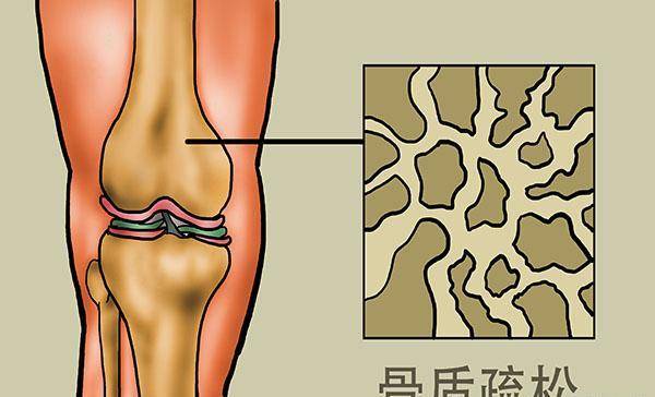 老年人摔一跤，成果有多严峻？60岁以后，3种食物要舍得吃