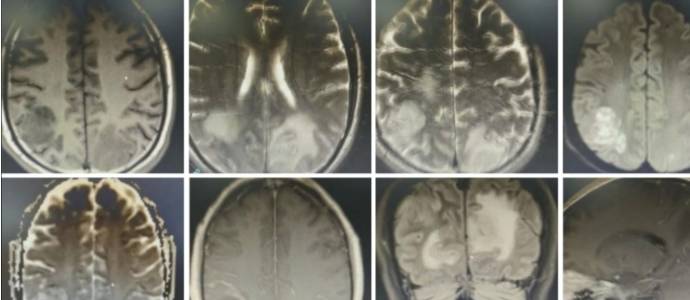 �Լ����没���͹�ע�Թ��������׶������ۺ���ح3���Ӷ�Ƭ ...