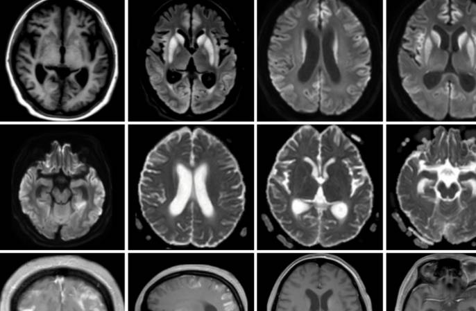 �Լ����没���͹�ע�Թ��������׶������ۺ���ح3���Ӷ�Ƭ ...