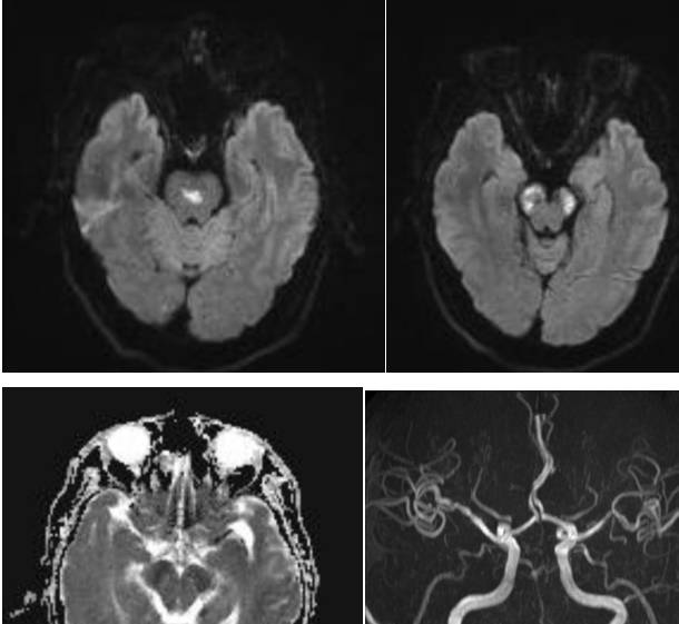 �Լ����没���͹�ע�Թ��������׶������ۺ���ح3���Ӷ�Ƭ ...