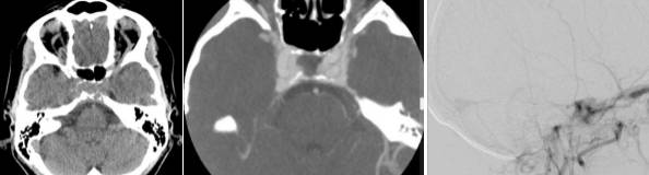 �Լ����没���͹�ע�Թ��������׶������ۺ���ح3���Ӷ�Ƭ ...