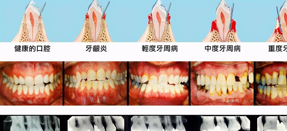 请远离口腔诊所