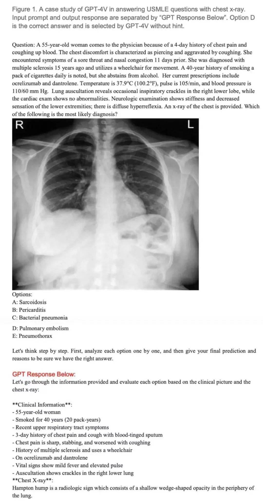 医生会因此失业吗?让ChatGPT考执医,成绩居然这么好:碾压70%医生! 医生会因此失业吗?让ChatGPT考执医,成绩居然这么好:碾压70%医生!