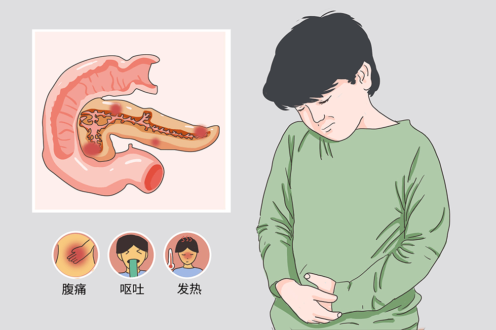 腺炎病史，未及时治疗的急性胰腺炎可能演变为慢性，增加胰腺癌变风险。