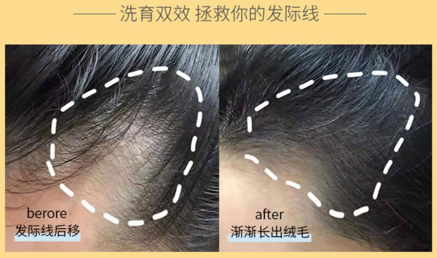 硬核推荐（真爱年华洗浴中心电话号码）真爱年华洗浴代金券，什么牌子洗发水好?2023年度真爱防脱洗发水!，