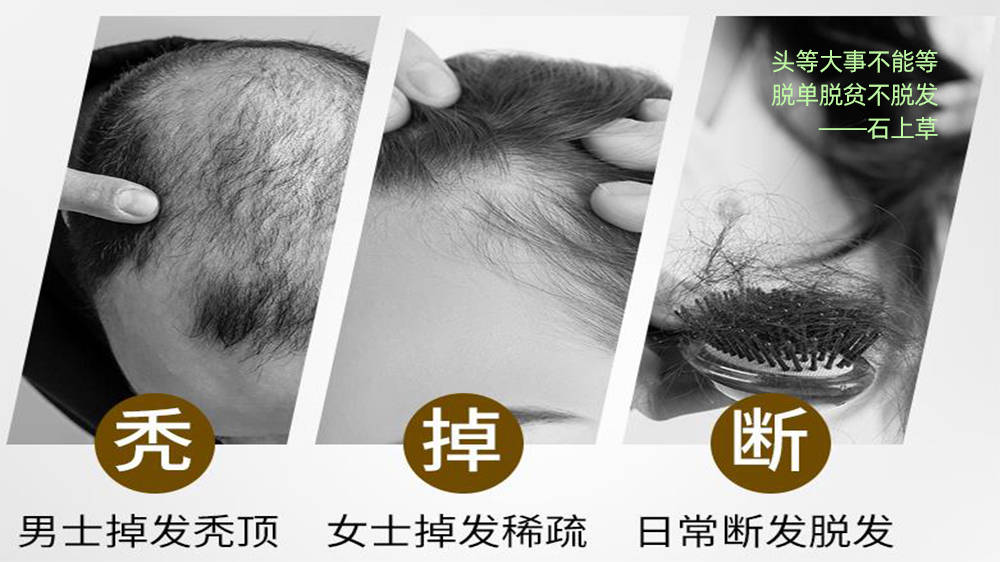 油性头发用什么洗发水最好？真的有用呢