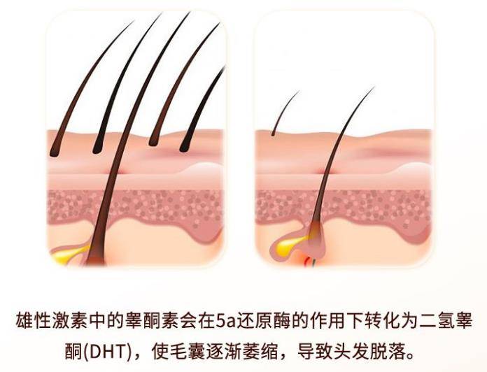 女性防脫洗發(fā)水哪個牌子的好？認真做功課買的防脫洗發(fā)水