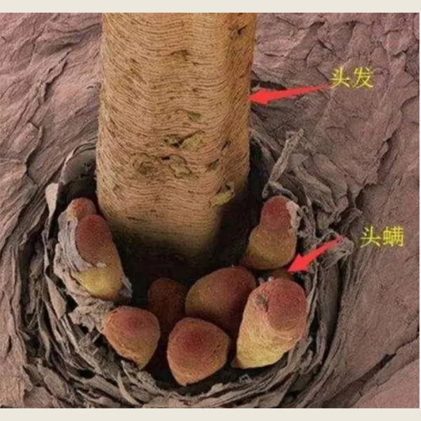 头上毛囊炎用啥洗头发？【用户评价，推荐头皮护理品牌】