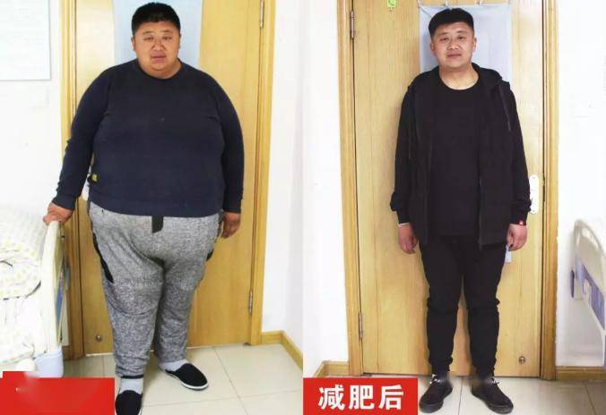 12个月减重240斤 420斤巨胖涅盘重生