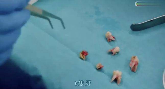 「孩子」同款复制还是不行怎么办？孙俪教育孩子刷牙获赞10W+