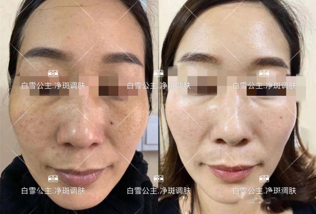 520宠粉福利,金浦白雪公主给你更美的陪伴