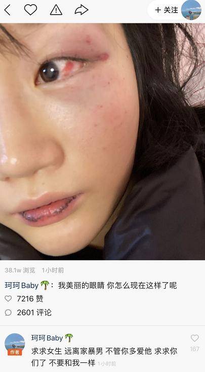 ks百万粉丝女网红被男友家暴！直播哭喊救命！仙女拒绝签约仙洋传媒表态：公司都是我的！