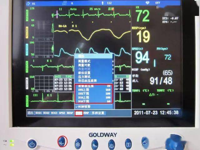 心电监护仪怎么看数值