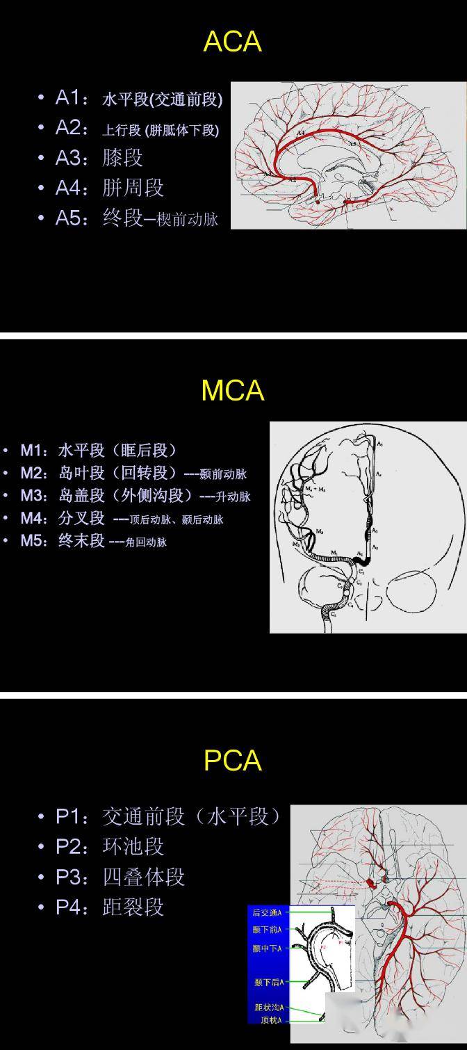 大脑前动脉 aca,大脑中动脉 mca,大脑后动脉 pca,前交通动脉 acoa,后