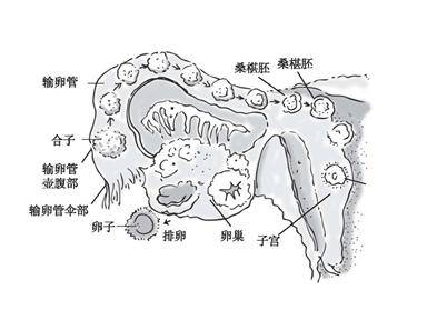 正常情况下,输卵管见证完毕精子先生与卵子小姐在输卵管壶腹部的这场