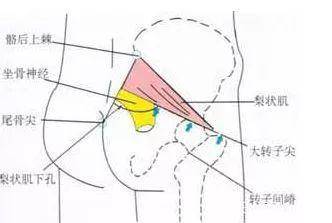 【干货】深入细说坐骨神经痛