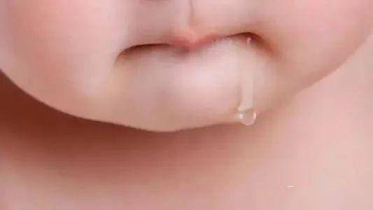 一周岁宝宝,牙龈红肿,舌头溃疡,口臭,流口水,吃奶 口臭 百姓问
