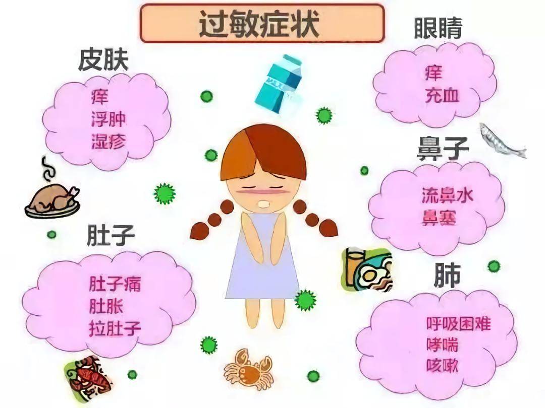 牛奶蛋白过敏喝母乳是不是也会过敏 534ae7d21211462f83798ec5f7621451.jpeg
